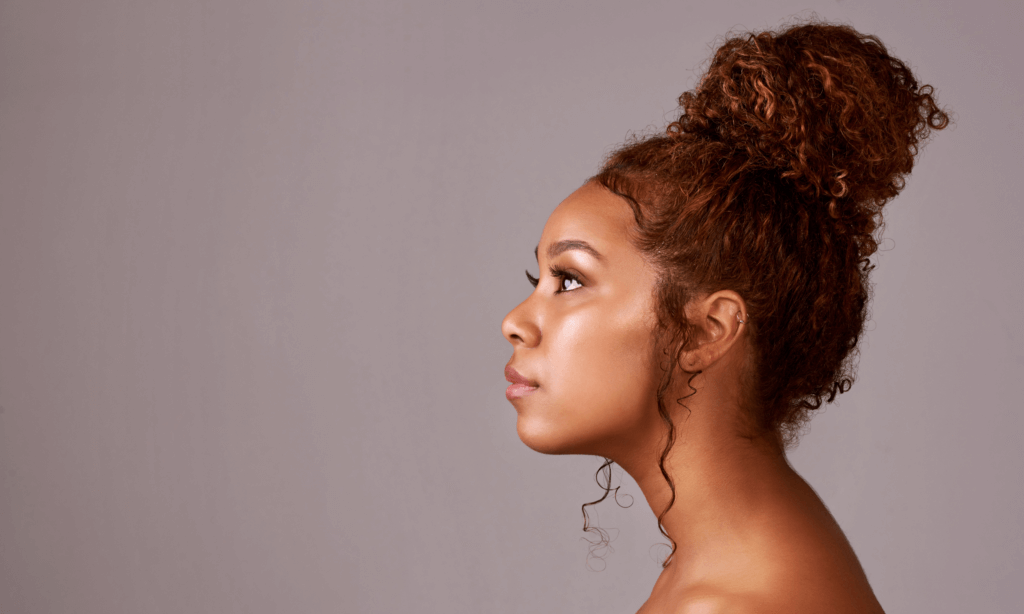 Woman Side profile rhinoplasty